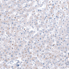 Immunohistochemical staining of human liver shows very weak cytoplasmic positivity in hepatocytes.