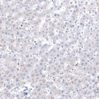 Immunohistochemical staining of human liver shows very weak cytoplasmic positivity in hepatocytes.