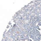 Immunohistochemical staining of human kidney shows negative to very weak cytoplasmic positivity in cells in tubules.