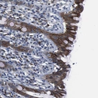 Immunohistochemical staining of human rectum shows strong membranous positivity in glandular cells.