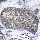 Immunohistochemical staining of human testis shows moderate membranous positivity in cells in seminiferous ducts.
