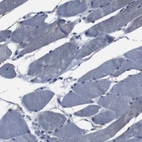 Immunohistochemical staining of human skeletal muscle shows negative membranous positivity in myocytes as expected.