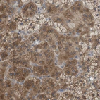 Anti-DDRGK1 Antibody