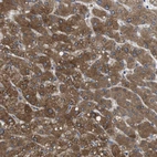 Immunohistochemical staining of human liver shows strong cytoplasmic positivity in hepatocytes.
