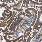 Immunohistochemical staining of human duodenum shows strong cytoplasmic positivity in glandular cells.