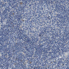 Anti-DDRGK1 Antibody