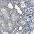 Anti-PARD6B Antibody