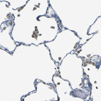 Immunohistochemical staining of human lung shows moderate cytoplasmic positivity in macrophages.