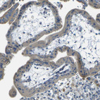 Immunohistochemical staining of human placenta shows weak cytoplasmic positivity in trophoblastic cells.