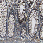 Anti-RELL1 Antibody