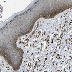 Immunohistochemical staining of human skin shows moderate membranous positivity in squamous epithelial cells.