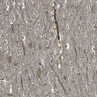 Immunohistochemical staining of human cerebral cortex shows strong membranous positivity in neurons.