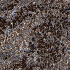 Immunohistochemical staining of human Lymph node shows strong granular cytoplasmic positivity in non-germinal center cells.