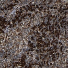 Immunohistochemical staining of human Lymph node shows strong granular cytoplasmic positivity in non-germinal center cells.