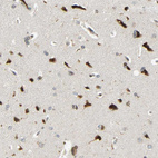 Immunohistochemical staining of human Cerebral cortex shows strong granular cytoplasmic positivity in neuronal cells.