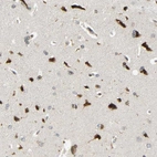 Immunohistochemical staining of human Cerebral cortex shows strong granular cytoplasmic positivity in neuronal cells.