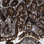 Immunohistochemical staining of human Colon shows strong granular cytoplasmic positivity in glandular cells.