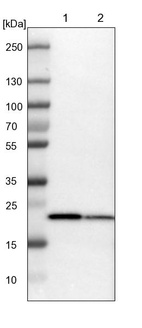 Lane 1: NIH-3T3 cell lysate (Mouse embryonic fibroblast cells)_br/_Lane 2: NBT-II cell lysate (Rat Wistar bladder tumour cells)