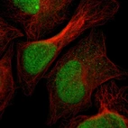 Immunofluorescent staining of human cell line U-2 OS shows localization to nucleus.