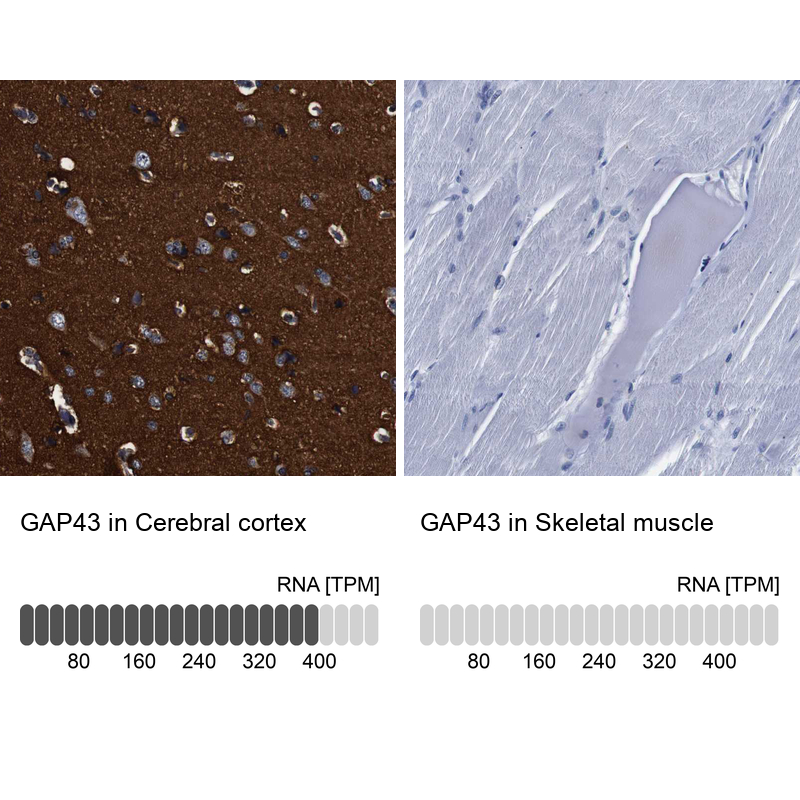 Anti-GAP43 Antibody
