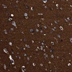 Immunohistochemical staining of human Cerebral cortex shows strong cytoplasmic positivity in neuropil.