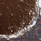 Immunohistochemical staining of human Cerebellum shows strong cytoplasmic positivity in cells in molecular layer.
