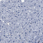 Immunohistochemical staining of human Liver shows no positivity in hepatocytes as expected.