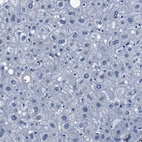 Immunohistochemical staining of human Liver shows no positivity in hepatocytes as expected.