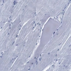 Immunohistochemical staining of human Skeletal muscle shows no positivity in myocytes as expected.