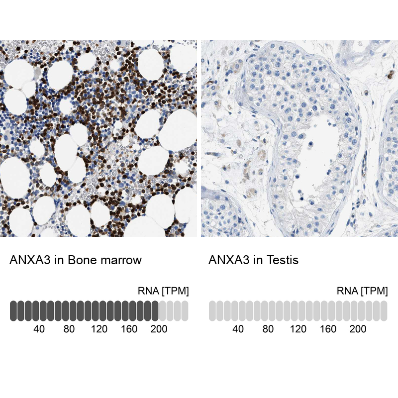 Anti-ANXA3 Antibody