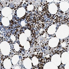 Immunohistochemical staining of human bone marrow shows strong cytoplasmic positivity in hematopoietic cells.