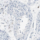 Immunohistochemical staining of human testis shows no positivity in cells in seminiferous ducts as expected.