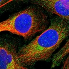 Immunofluorescent staining of human cell line U-2 OS shows localization to cytosol.