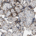 Immunohistochemical staining of human placenta shows weak to moderate cytoplasmic positivity in trophoblastic cells.
