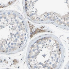 Immunohistochemical staining of human testis shows moderate cytoplasmic positivity in Leydig cells.