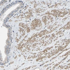 Immunohistochemical staining of human prostate shows moderate cytoplasmic positivity in smooth muscle cells.