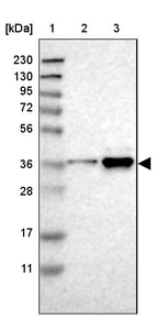 Lane 1: Marker [kDa] 230, 130, 95, 72, 56, 36, 28, 17, 11_br/_Lane 2: Human cell line RT-4_br/_Lane 3: Human cell line U-251MG sp
