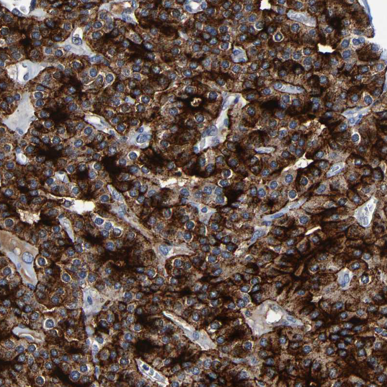 Anti-LRRC70 Antibody