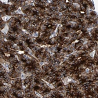 Anti-LRRC70 Antibody