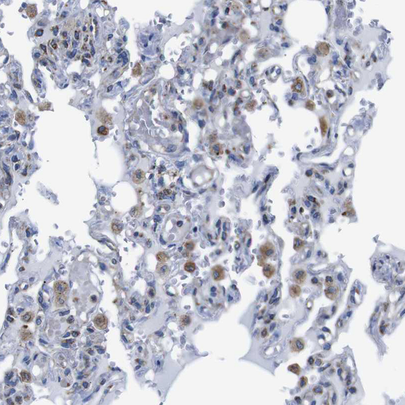 Anti-PDCD1LG2 Antibody
