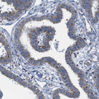 Immunohistochemical staining of human fallopian tube shows moderate cytoplasmic positivity in glandular cells.