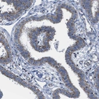 Immunohistochemical staining of human fallopian tube shows moderate cytoplasmic positivity in glandular cells.