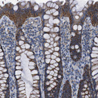 Immunohistochemical staining of human colon shows moderate cytoplasmic positivity in glandular cells.
