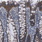 Immunohistochemical staining of human colon shows moderate cytoplasmic positivity in glandular cells.