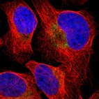 Immunofluorescent staining of human cell line U-2 OS shows localization to cytosol.