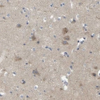 Immunohistochemical staining of human cerebral cortex shows moderate cytoplasmic positivity in neurons.