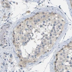 Immunohistochemical staining of human testis shows weak cytoplasmic positivity in cells in seminiferous ducts.