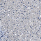 Immunohistochemical staining of human liver shows no positivity in hepatocytes as expected.