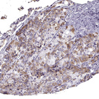 Anti-GNRHR Antibody