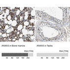 Anti-ANXA3 Antibody